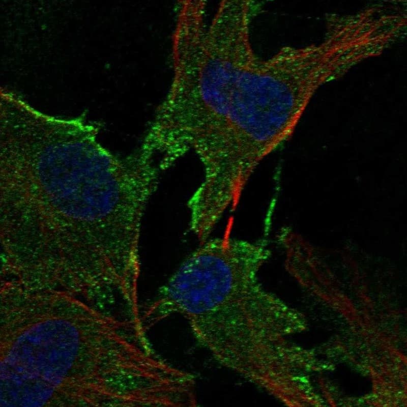 Staining of human cell line BJ shows localization to plasma membrane & vesicles.
