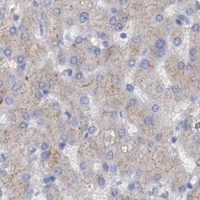 Staining of human liver.