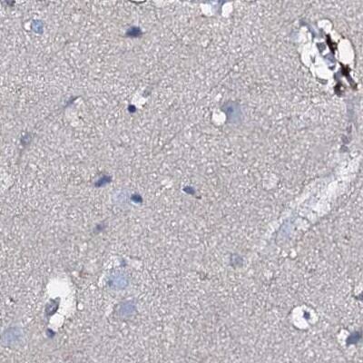 Staining of human cerebral cortex.