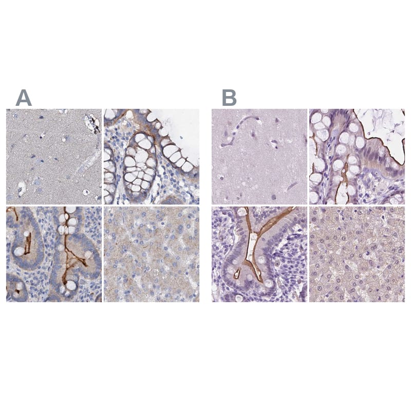 <b>Orthogonal Strategies Validation. </b>Staining of human cerebral cortex, colon, duodenum and liver HPA039219 (A) shows similar protein distribution across tissues to independent antibody HPA048187 (B).