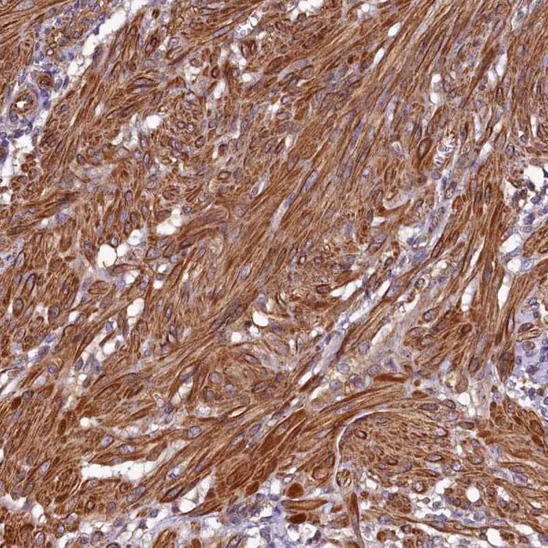 Immunohistochemistry-Paraffin CCDC102B Antibody - BSA Free