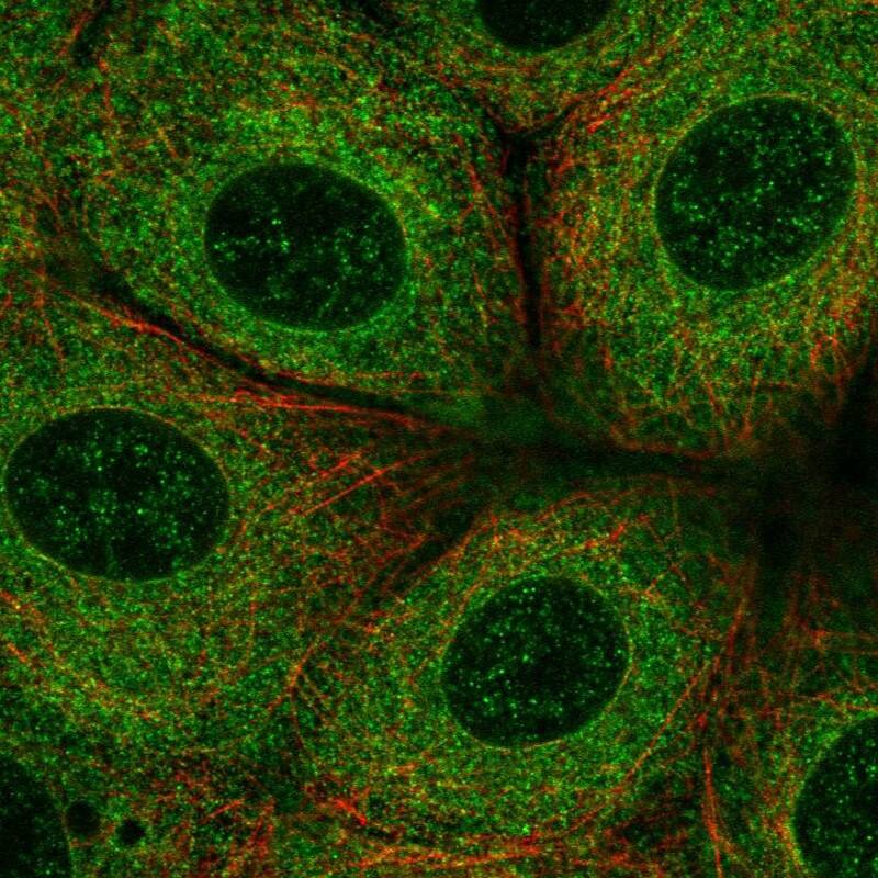 Immunocytochemistry/ Immunofluorescence FATP3/SLC27A3 Antibody - BSA Free