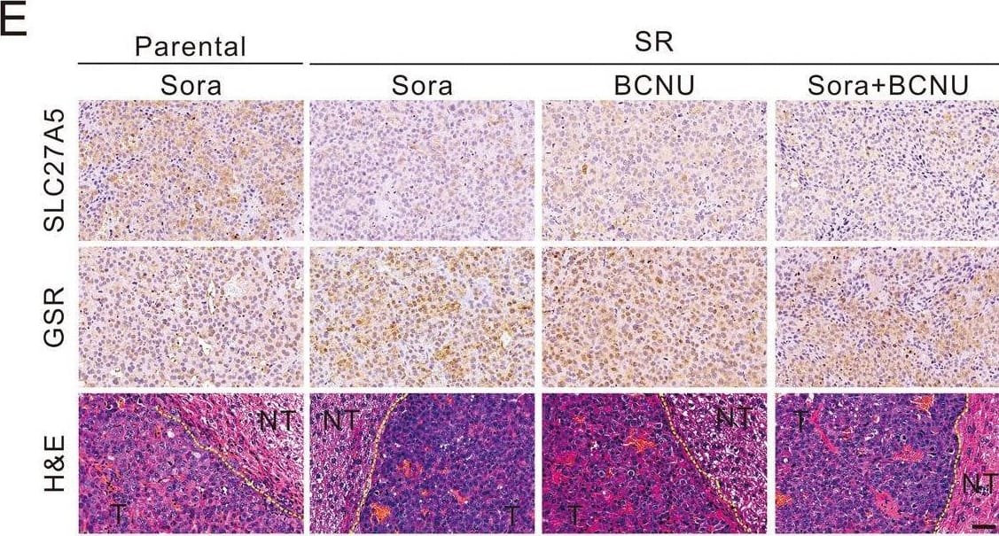 BCNU enhances the curative effect of sorafenib in vivo by inducing ferroptosis.A Establishment protocol for the evaluation of tumor growth and resistance of human HepG2-parental and HepG2-SR tumor xenografts in BALB/C nude mice following therapy with sorafenib and BCNU alone or both. B Gross images of the HepG2-derived xenografts in orthotopic implantation model. C, D Analysis of liver/body weight ratio (C) (n = 6) and tumor numbers (D) (n = 6). E, F Relative protein expression of SLC27A5 and GSR in the tumor tissues was assayed by immunohistochemistry (E) and immunoblotting (F). Scale bar: 50 μm. G–I The level of GSR activity (G) (n = 6), GSH/GSSG ratio (H) (n = 6), and ROS (I) (n = 6) were assayed in tumor tissues. Scale bar: 10 μm. Data shown are mean +/- SD. Statistical significance was calculated using one-way ANOVA test. *p < 0.05, **p < 0.01, ***p < 0.001. Image collected and cropped by CiteAb from the following open publication (//pubmed.ncbi.nlm.nih.gov/36635256), licensed under a CC-BY license. Not internally tested by Novus Biologicals.
