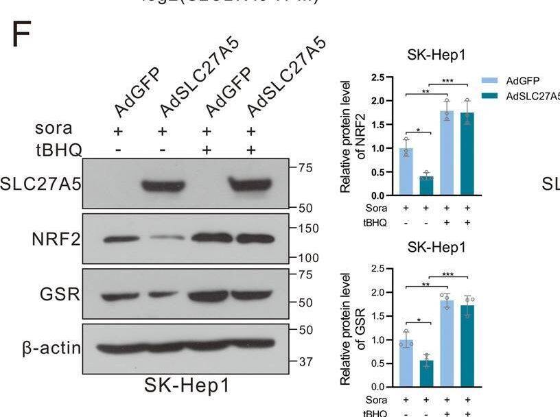 SLC27A5 depletion activated NRF2/GSR axis in HCC.A, B Representative mRNA levels of NRF2 downstream gene expression in SLC27A5-overexpression (A) and SLC27A5-KO (B) cells under treatment of sorafenib. C Relative mRNA levels of GSR in sorafenib-sensitive (n = 3) and sorafenib-resistant (n = 3) human liver tumors. D Correlation analysis of the mRNA levels of SLC27A5 and GSR in the liver by Spearman. E Histochemical staining for SLC27A5 and GSR in HCC tissues and adjacent non-cancerous tissues. Scale bar: 50 μm. F Relative protein expression of NRF2 and GSR were detected by western blotting in SLC27A5-overexpression SK-Hep1 cultured with sorafenib (10 μM for 24 h) alone or co-treatment with tBHQ (100 μM for 3 h). G Relative protein expression of NRF2 and GSR were detected by western blotting in SLC27A5-KO HepG2 cultured with sorafenib alone or co-treatment with brusatol (40 nM for 24 h). H Kaplan–Meier survival curve analysis based on the expression of SLC27A5 and GSR in the liver tumor. I, J The activity of GSR was determined by the GSR activity kit in SLC27A5-overexpression SK-Hep1 (I) and SLC27A5-KO HepG2 (J). TPM transcripts per million, tBHQ tertiary butylhydroquinone, Bru brusatol. Data shown are mean +/- SD (n = 3). Statistical significance was calculated using two-tailed unpaired Student’s t-test and one-way ANOVA test. *p < 0.05, **p < 0.01 ***p < 0.001. Image collected and cropped by CiteAb from the following open publication (//pubmed.ncbi.nlm.nih.gov/36635256), licensed under a CC-BY license. Not internally tested by Novus Biologicals.