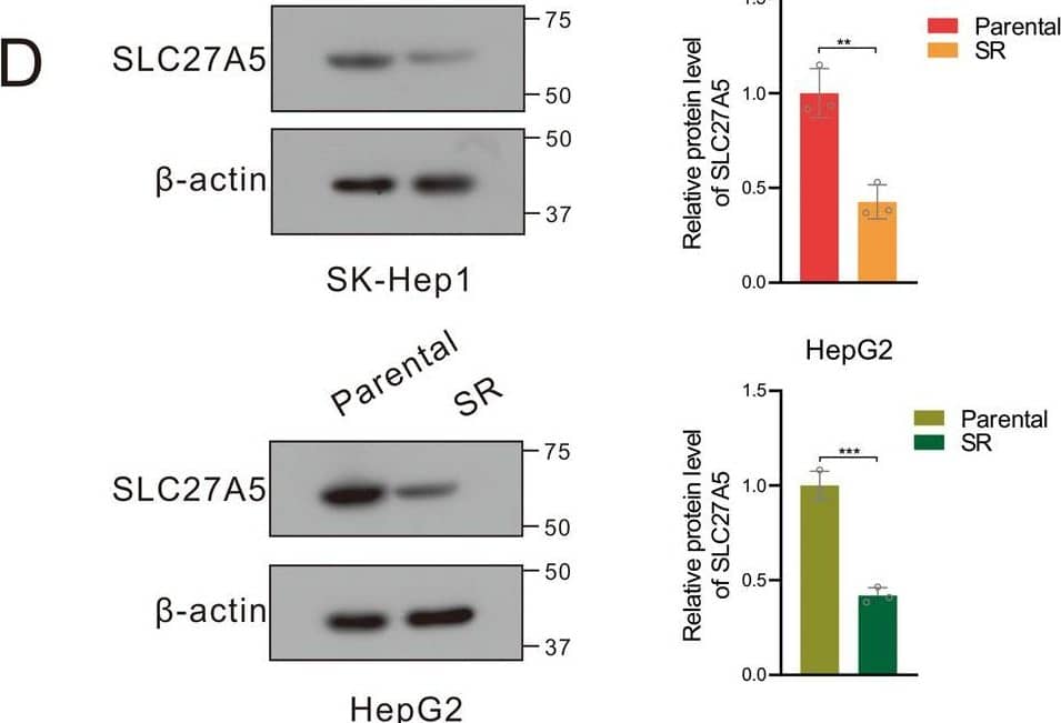 SLC27A5 expression is downregulated in the sorafenib-resistant hepatocellular carcinoma cells.A Schematic diagram of the construction of the sorafenib-resistant cells. B The IC50 values of sorafenib-sensitive and sorafenib-resistant SK-Hep1 and HepG2 cells that were incubated with sorafenib in a concentration gradient manner. C, D The mRNA (C) and protein (D) expression of SLC27A5 in sorafenib-sensitive and sorafenib-resistant HCC cells. SR sorafenib resistant. All data are presented as mean +/- SD (n = 3). Statistical significance was calculated using two-tailed unpaired Student’s t-test. *p < 0.05, **p < 0.01, ***p < 0.001. Image collected and cropped by CiteAb from the following open publication (//pubmed.ncbi.nlm.nih.gov/36635256), licensed under a CC-BY license. Not internally tested by Novus Biologicals.