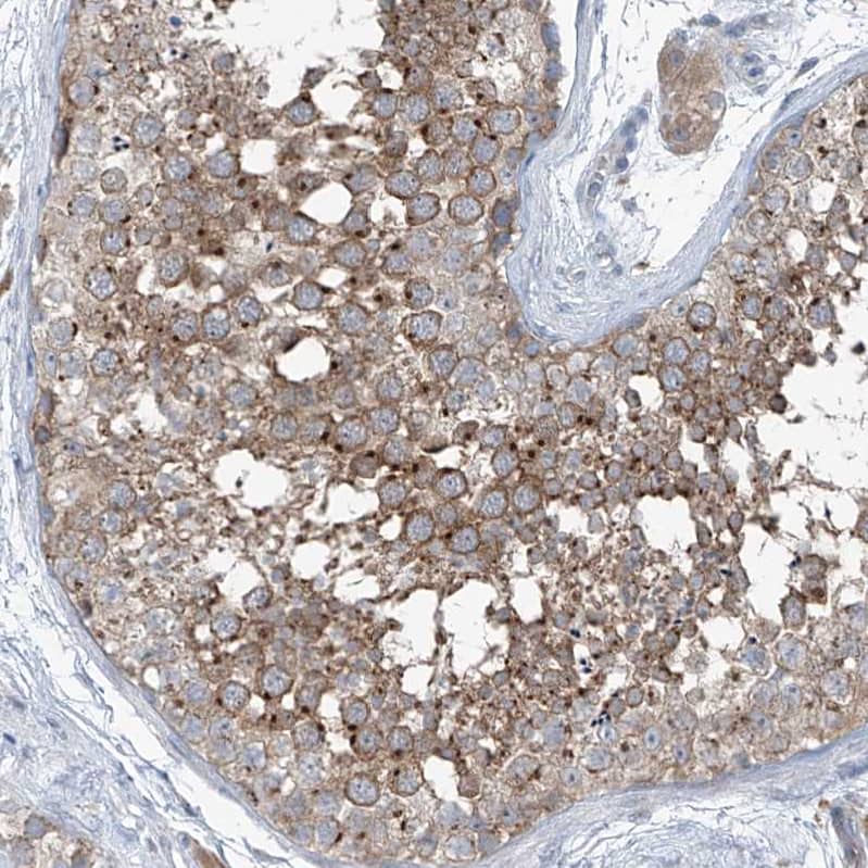 Immunohistochemistry-Paraffin KCC3/SLC12A6 Antibody - BSA Free