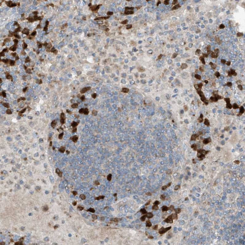 Staining of human Lymph node shows moderate membranous and cytoplasmic positivity in germinal and non-germinal center cells.