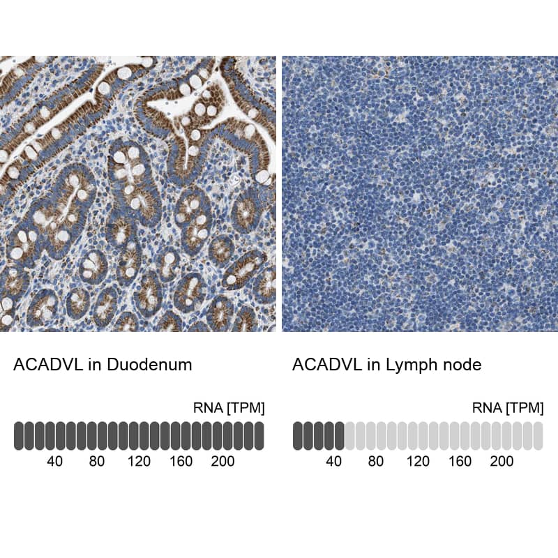 Immunohistochemistry-Paraffin ACADVL Antibody - BSA Free