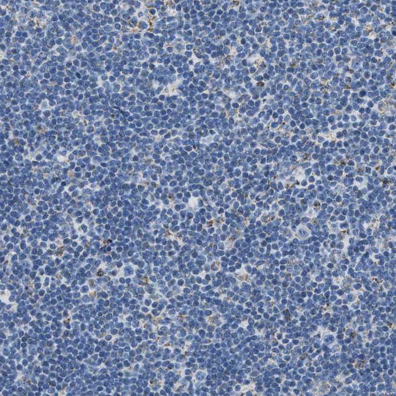 Immunohistochemistry-Paraffin ACADVL Antibody - BSA Free