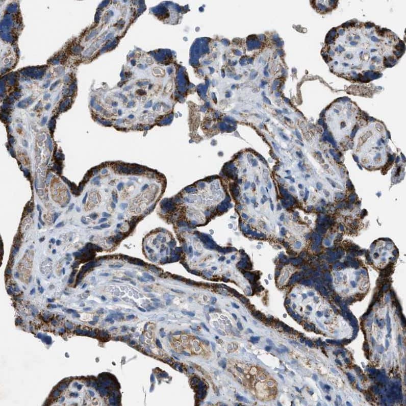 Immunohistochemistry-Paraffin ACADVL Antibody - BSA Free