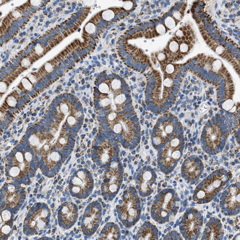 Immunohistochemistry-Paraffin ACADVL Antibody - BSA Free