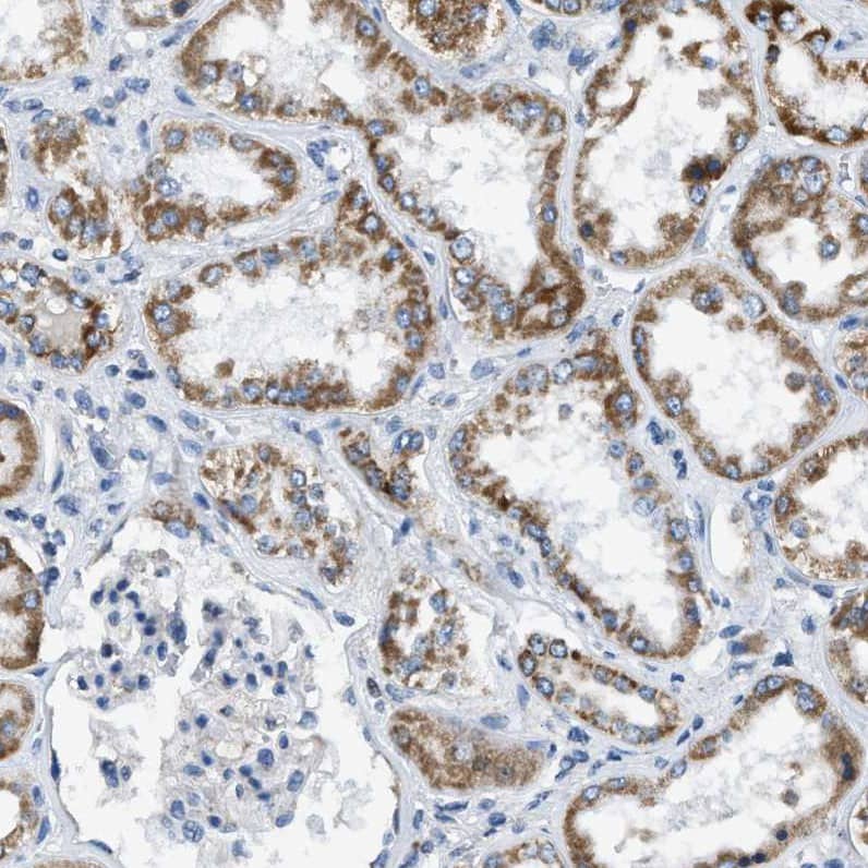 Immunohistochemistry-Paraffin ACADVL Antibody - BSA Free