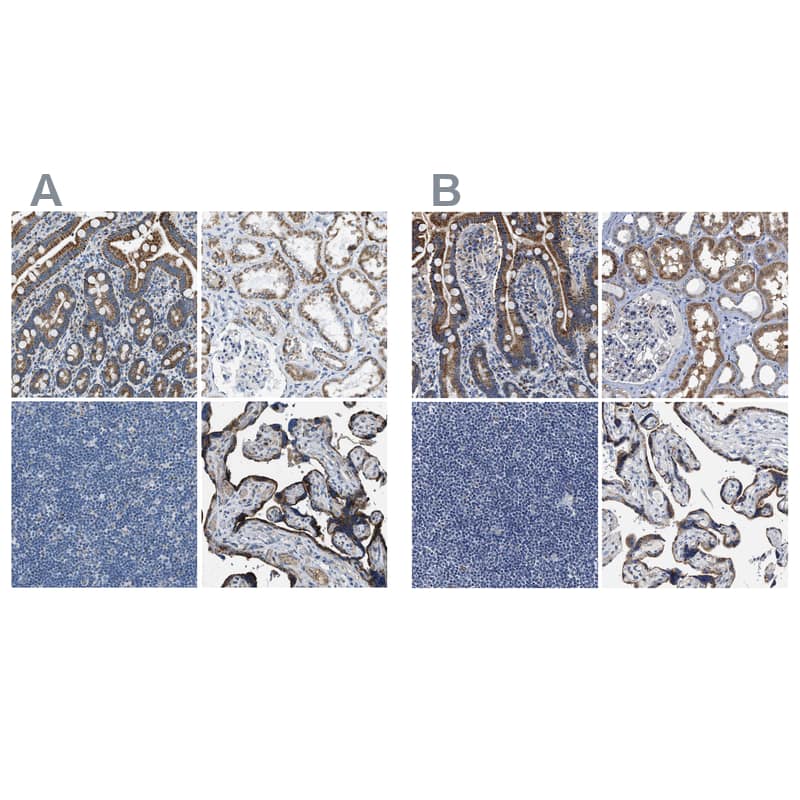 Immunohistochemistry-Paraffin ACADVL Antibody - BSA Free