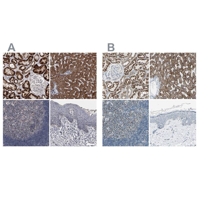 Staining of human kidney, liver, lymph node and skin .