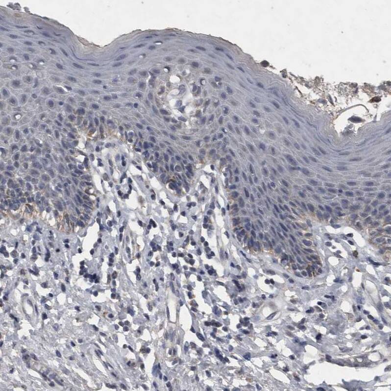 Staining of human skin shows no positivity in squamous epithelial cells as expected.