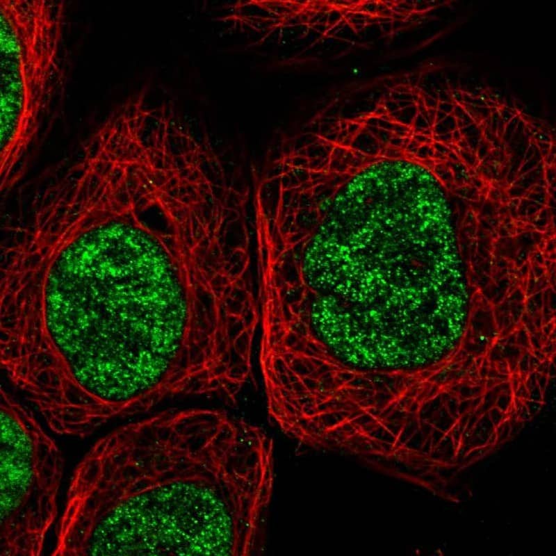 Immunocytochemistry/ Immunofluorescence DDX41 Antibody - BSA Free