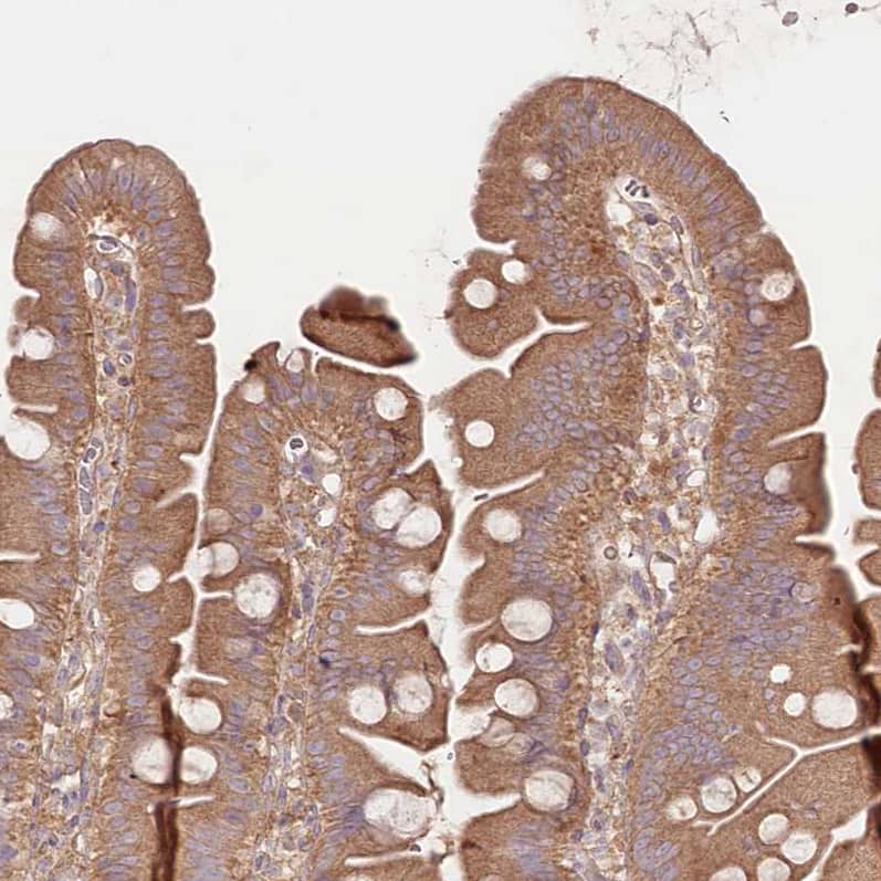 Staining of human small intestine shows moderate  cytoplasmic positivity in glandular cells.