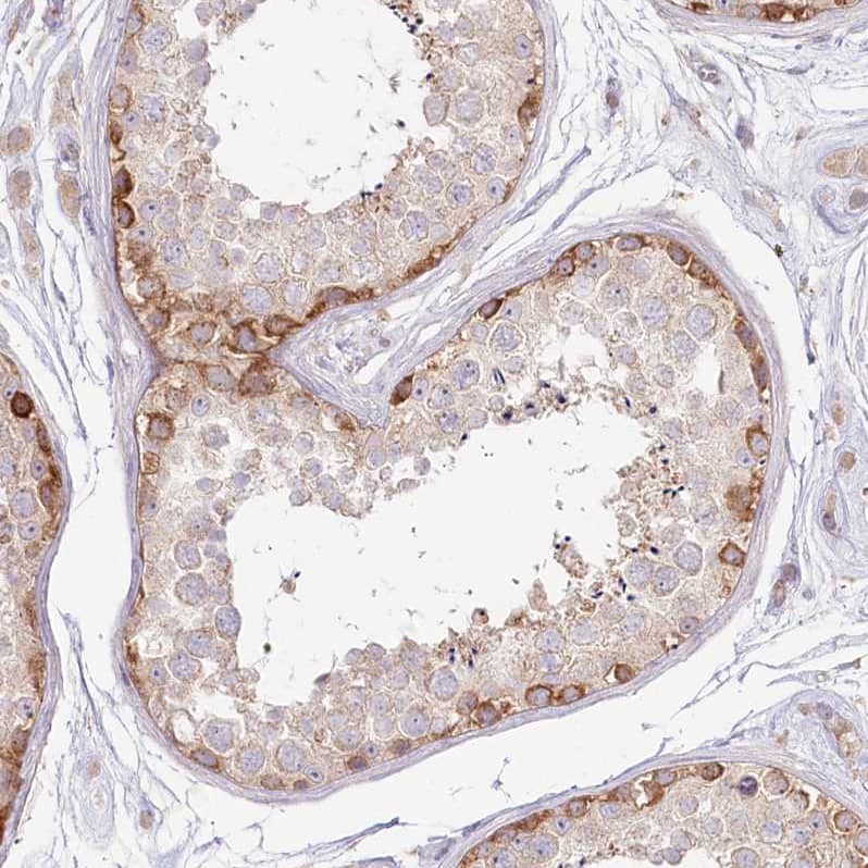 Staining of human Testis shows moderate cytoplasmic positivity in cells in seminiferous ducts.