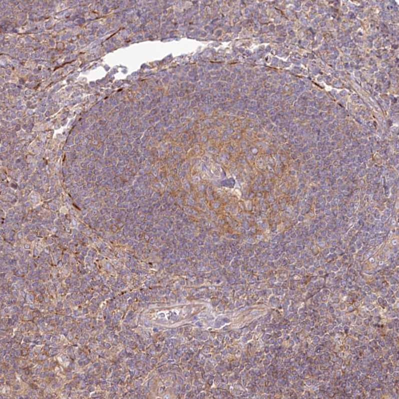 Staining of human lymph node shows moderate cytoplasmic positivity in germinal center cells.