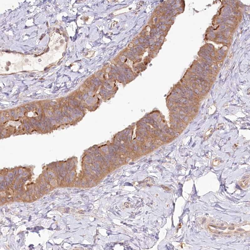 Staining of human Fallopian tube shows moderate cytoplasmic positivity in glandular cells.