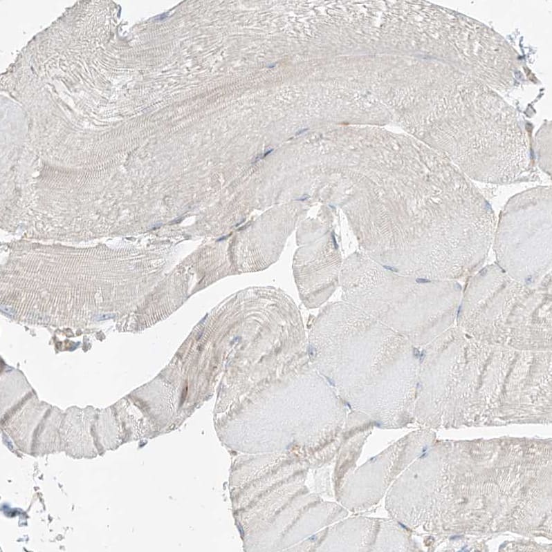 Staining of human skeletal muscle shows no positivity in myocytes as expected.