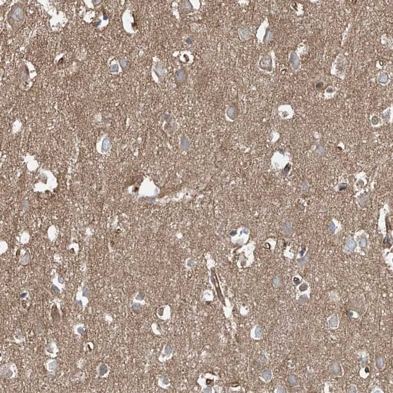 Staining of human cerebral cortex shows strong cytoplasmic positivity in neurons.