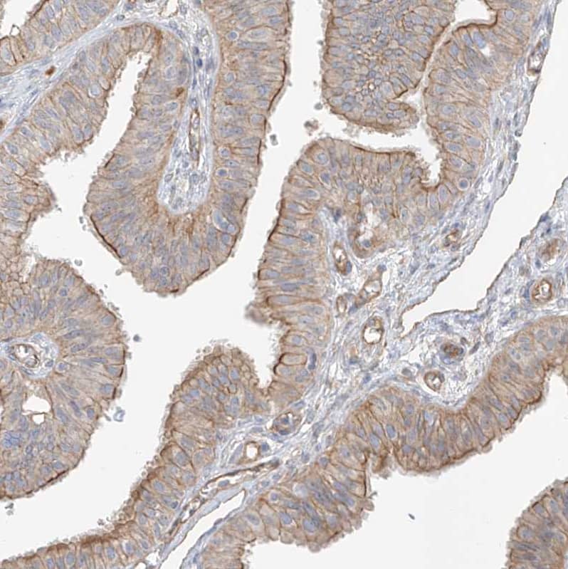 Staining of human fallopian tube shows moderate membranous positivity in glandular cells.