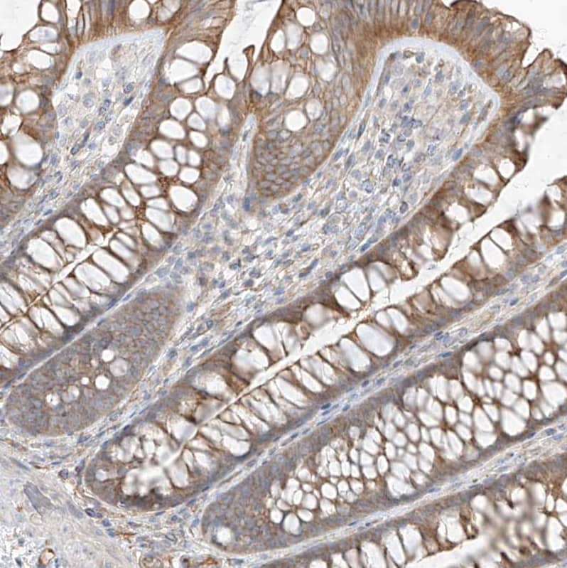 Staining of human gastrointestinal shows moderate membranous positivity in glandular cells.