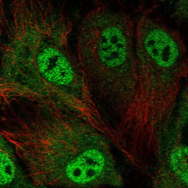 Staining of human cell line HUVEC TERT2 shows localization to nucleoplasm & cytosol.
