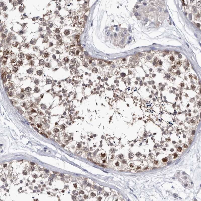 Staining of human testis shows high expression.