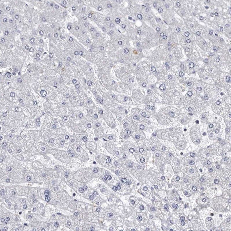 Staining of human liver shows low expression as expected.