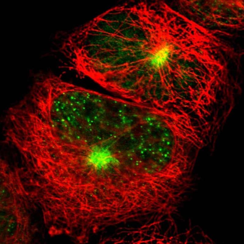 Immunocytochemistry/ Immunofluorescence LMTK2 Antibody - BSA Free
