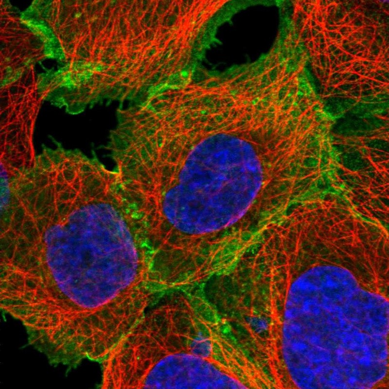 Staining of human cell line A-431 shows localization to plasma membrane.