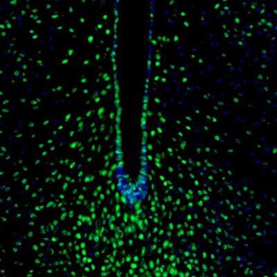 Staining of mouse hypothalamus shows nuclear immunoreactivity in the neurons in the arcuate nucleus.