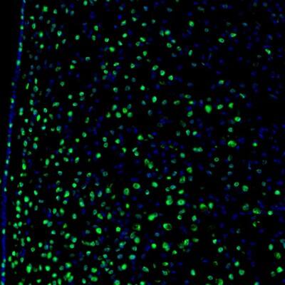Staining of mouse hypothalamus shows nuclear positivity in the neurons of medial preoptic area.
