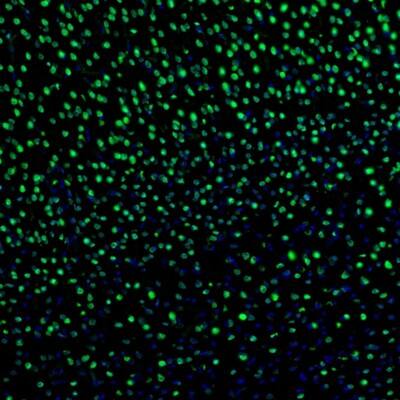 Staining of mouse visual cortex shows nuclear positivity in neurons.