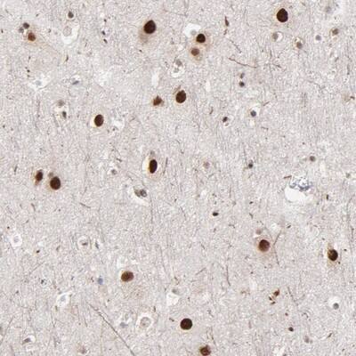 Staining of human cerebral cortex shows nuclear positivity in neuronal cells.