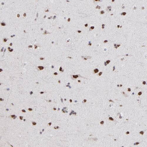 Staining of human cerebral cortex shows strong nuclear immunoreactivity in neurons.