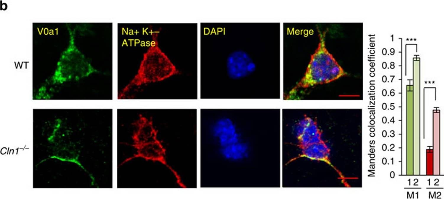 Immunocytochemistry/ Immunofluorescence: ATP6V0A1 Antibody [NBP1-89342] - In Cln1−/− mice V0a1 is misrouted to plasma membrane preventing its interaction with AP-3.(a) Western blot analysis & densitometric quantitation of V0a1 in isolated plasma membrane fraction from WT & Cln1−/− mouse brain (n=4, *P<0.05). (b) Localization of V0a1 in the plasma membrane in WT & Cln1−/− neurons using Na+, K+-ATPase as membrane marker. Colocalization between V0a1 & Na+, K+-ATPase was assessed using the Manders' colocalization coefficients M1 & M2 (n=18 for WT & n=22 for Cln1−/−, ***P<0.001; scale bars, 5 μm. (c) Pull-down assay with AP-3 antibody detects V0a1 in total brain lysates from WT & Cln1−/− mouse brain (n=4, *P<0.05). (d) Confocal imaging of PLA reaction showing V0a1 & AP-3δ interaction in neurons isolated from WT & Cln1−/−mouse brain (n=188 for WT & n=158 for Cln1−/−, ***P<0.001); scale bars, 20 μm. (e) Pull-down assay with AP-3 antibody using total lysates from untreated (lane 1) & bromopalmitate-treated (lane 2) WT brain slices to detect V0a1 & its densitometric quantitation (n=4, *P<0.05). (f) HEK-293 cells were transfected with WT GFP-V0a1 & GFP-V0a1-Cys25Ser mutant construct, & pull-down experiments were conducted with AP-3 antibody to detect GFP-V0a1,*P<0.05(n=4). Image collected & cropped by CiteAb from the following publication (//www.nature.com/articles/ncomms14612), licensed under a CC-BY license. Not internally tested by Novus Biologicals.