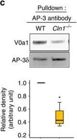 Western Blot: ATP6V0A1 Antibody [NBP1-89342] - In Cln1−/− mice V0a1 is misrouted to plasma membrane preventing its interaction with AP-3.(a) Western blot analysis & densitometric quantitation of V0a1 in isolated plasma membrane fraction from WT & Cln1−/− mouse brain (n=4, *P<0.05). (b) Localization of V0a1 in the plasma membrane in WT & Cln1−/− neurons using Na+, K+-ATPase as membrane marker. Colocalization between V0a1 & Na+, K+-ATPase was assessed using the Manders' colocalization coefficients M1 & M2 (n=18 for WT & n=22 for Cln1−/−, ***P<0.001; scale bars, 5 μm. (c) Pull-down assay with AP-3 antibody detects V0a1 in total brain lysates from WT & Cln1−/− mouse brain (n=4, *P<0.05). (d) Confocal imaging of PLA reaction showing V0a1 & AP-3δ interaction in neurons isolated from WT & Cln1−/−mouse brain (n=188 for WT & n=158 for Cln1−/−, ***P<0.001); scale bars, 20 μm. (e) Pull-down assay with AP-3 antibody using total lysates from untreated (lane 1) & bromopalmitate-treated (lane 2) WT brain slices to detect V0a1 & its densitometric quantitation (n=4, *P<0.05). (f) HEK-293 cells were transfected with WT GFP-V0a1 & GFP-V0a1-Cys25Ser mutant construct, & pull-down experiments were conducted with AP-3 antibody to detect GFP-V0a1,*P<0.05(n=4). Image collected & cropped by CiteAb from the following publication (//www.nature.com/articles/ncomms14612), licensed under a CC-BY license. Not internally tested by Novus Biologicals.