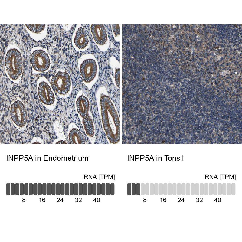 Analysis in human endometrium and tonsil tissues using NBP1-89361 antibody. Corresponding INPP5A RNA-seq data are presented for the same tissues.