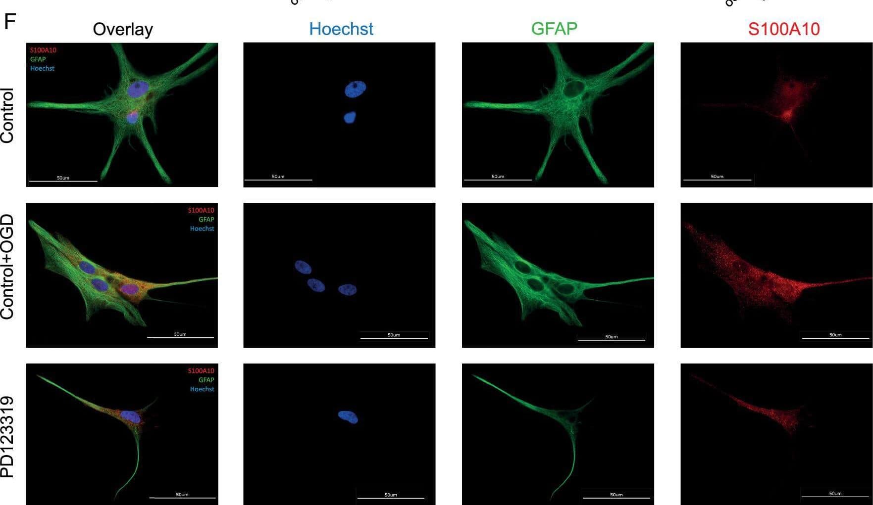 Immunocytochemistry/ Immunofluorescence S100A10 Antibody - BSA Free