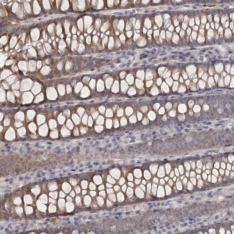 Staining of human colon shows moderate cytoplasmic positivity in glandular cells.