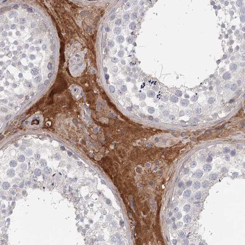Staining of human testis shows strong cytoplasmic positivity in Leydig cells.