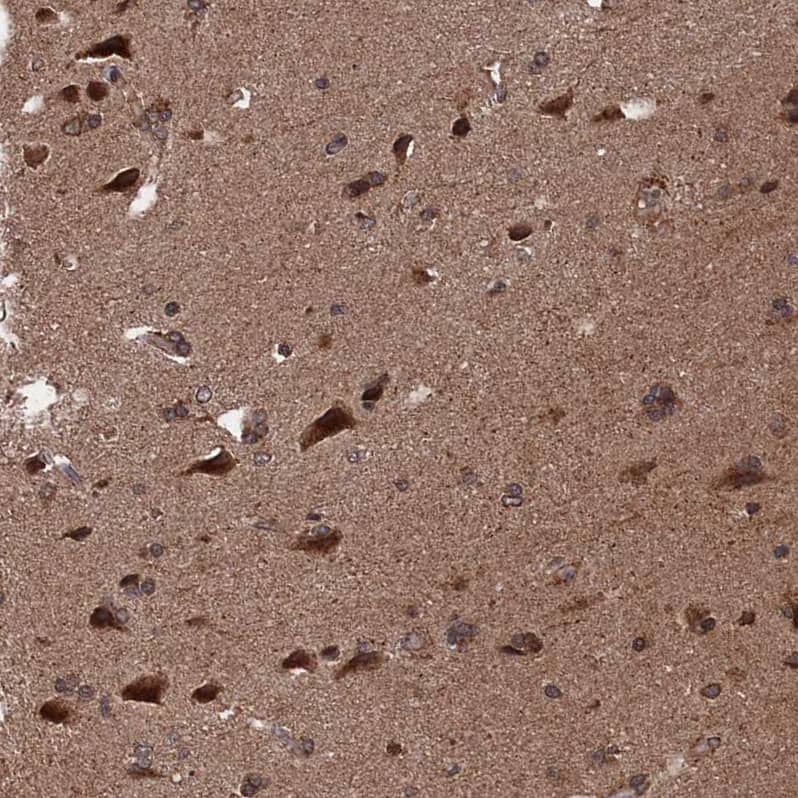 Immunohistochemistry-Paraffin PDE12 Antibody - BSA Free
