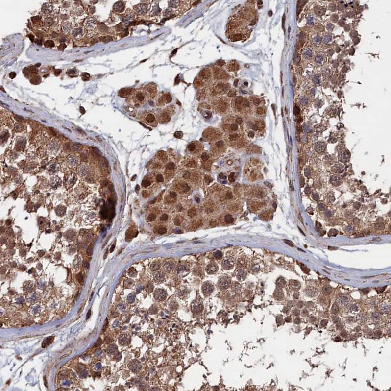 Immunohistochemistry-Paraffin PDE12 Antibody - BSA Free