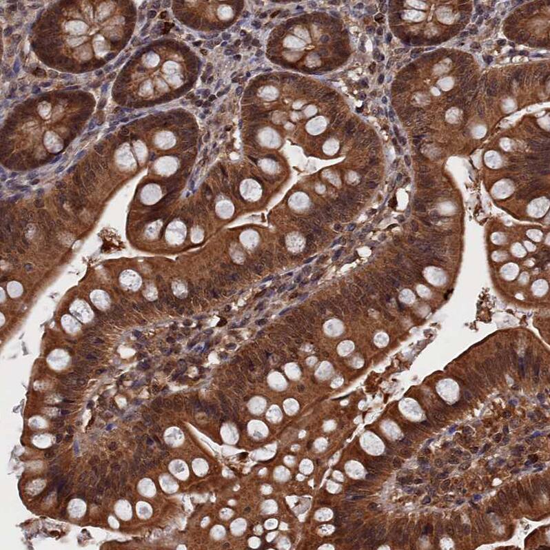 Immunohistochemistry-Paraffin PDE12 Antibody - BSA Free