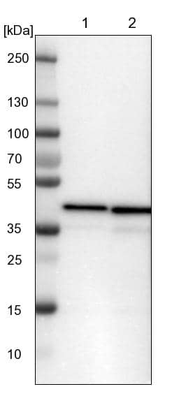 Lane 1: NIH-3T3 cell lysate (Mouse embryonic fibroblast cells)Lane 2: NBT-II cell lysate (Rat Wistar bladder tumour cells)