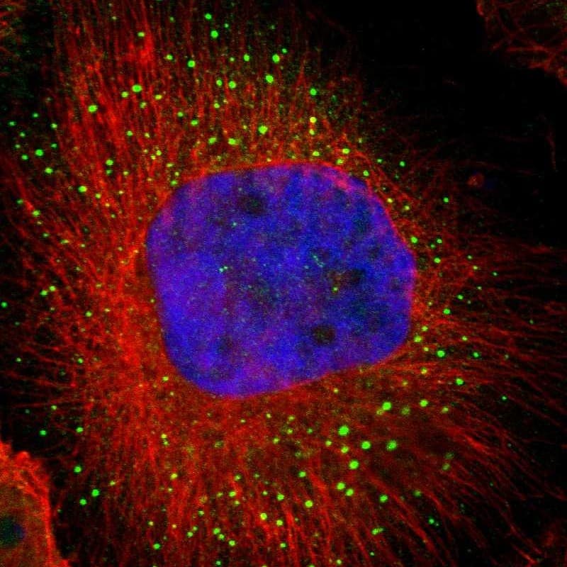 Staining of human cell line U-251 MG shows localization to vesicles.