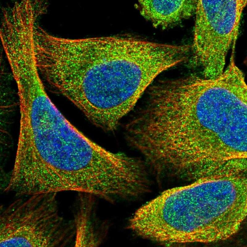 Staining of human cell line U-2 OS shows localization to cytosol.